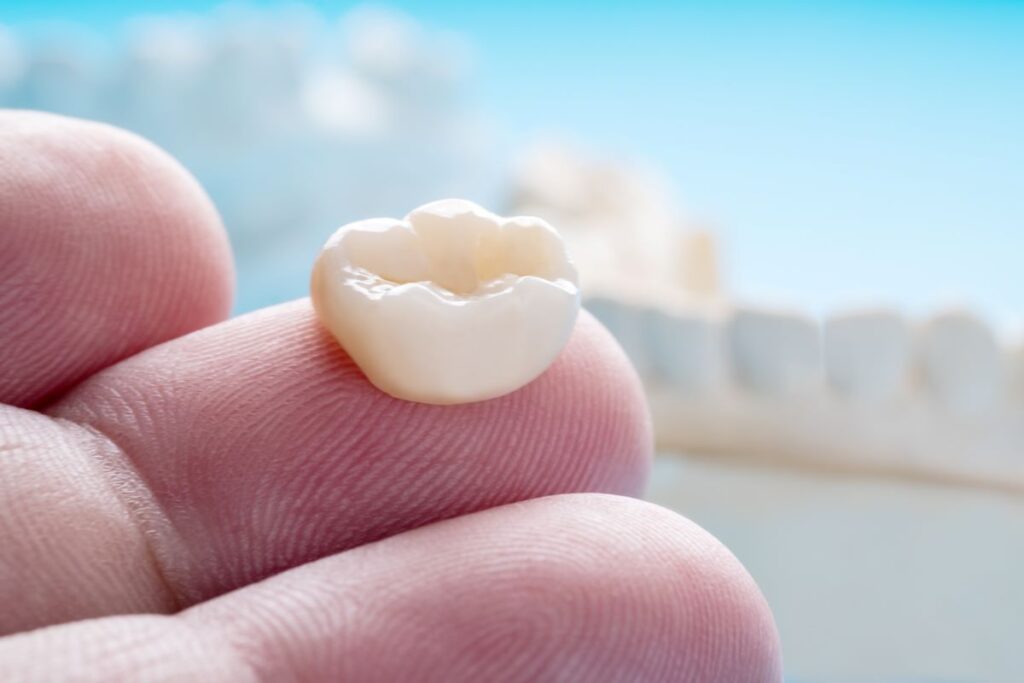 A dental crown sitting on a fingertip